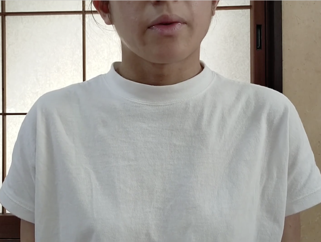 整体で変わる!アトピー・偏頭痛の改善。妊娠中の体調ケア 浜松市 27歳 Yさん